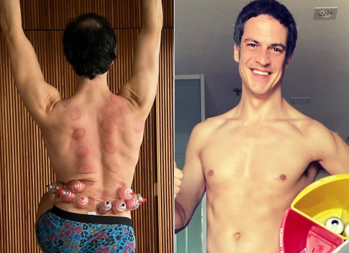 Mateus Solano posta foto de cueca durante sessão de ventosaterapia - Quem |  QUEM News