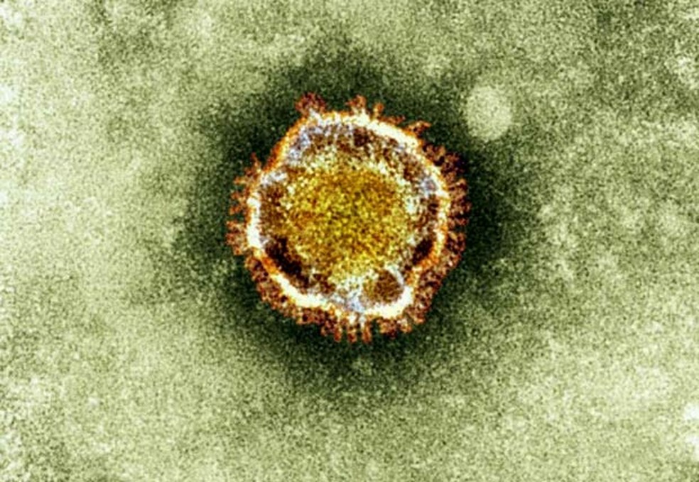 Imagem divulgada pela agência britânica de proteção à saúde mostra o coronavírus visto ao microscópio. Tipo de vírus é responsável pela MERS, infecção respiratória registrada na Arábia Saudita em 2012  (Foto: AFP)