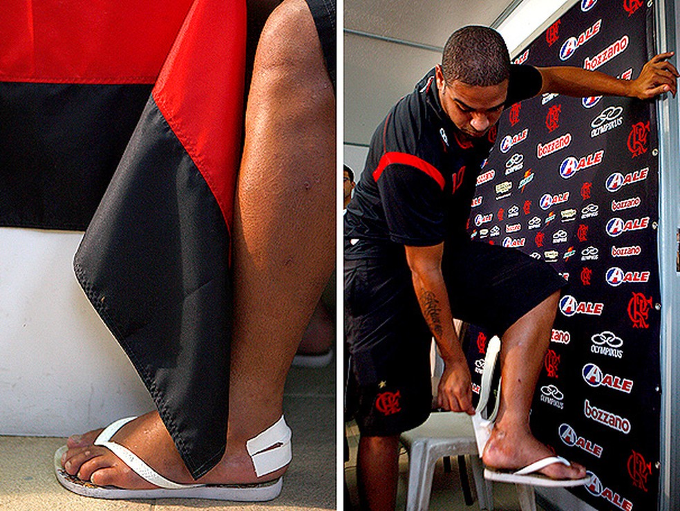 Adriano mostra a bolha que o tirou do jogo contra o Corinthians &mdash; Foto: Jorge William/O Globo