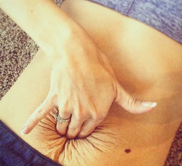 Corredora profissional mostra como ficou a sua barriga pós-parto (Foto: Reprodução/Instagram)