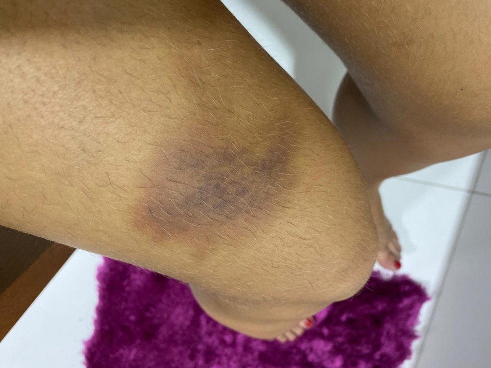 Últimas agressões sofridas por Carla ocorreram na semana passada — Foto: Carla Marina Reis/Arquivo pessoal