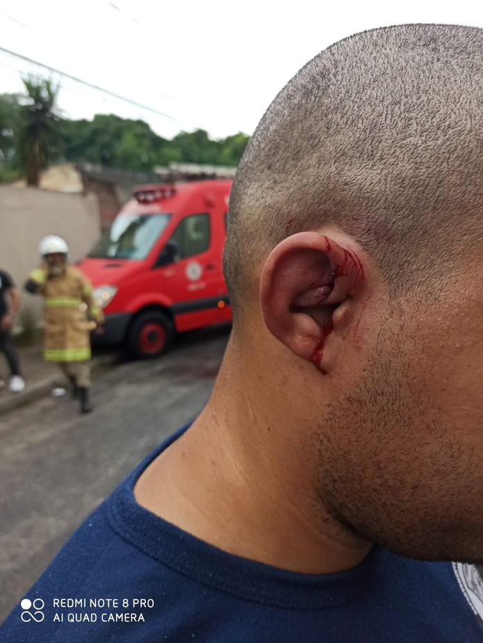 Agente é ferido na orelha durante rebelião — Foto: Divulgação/SindDegase