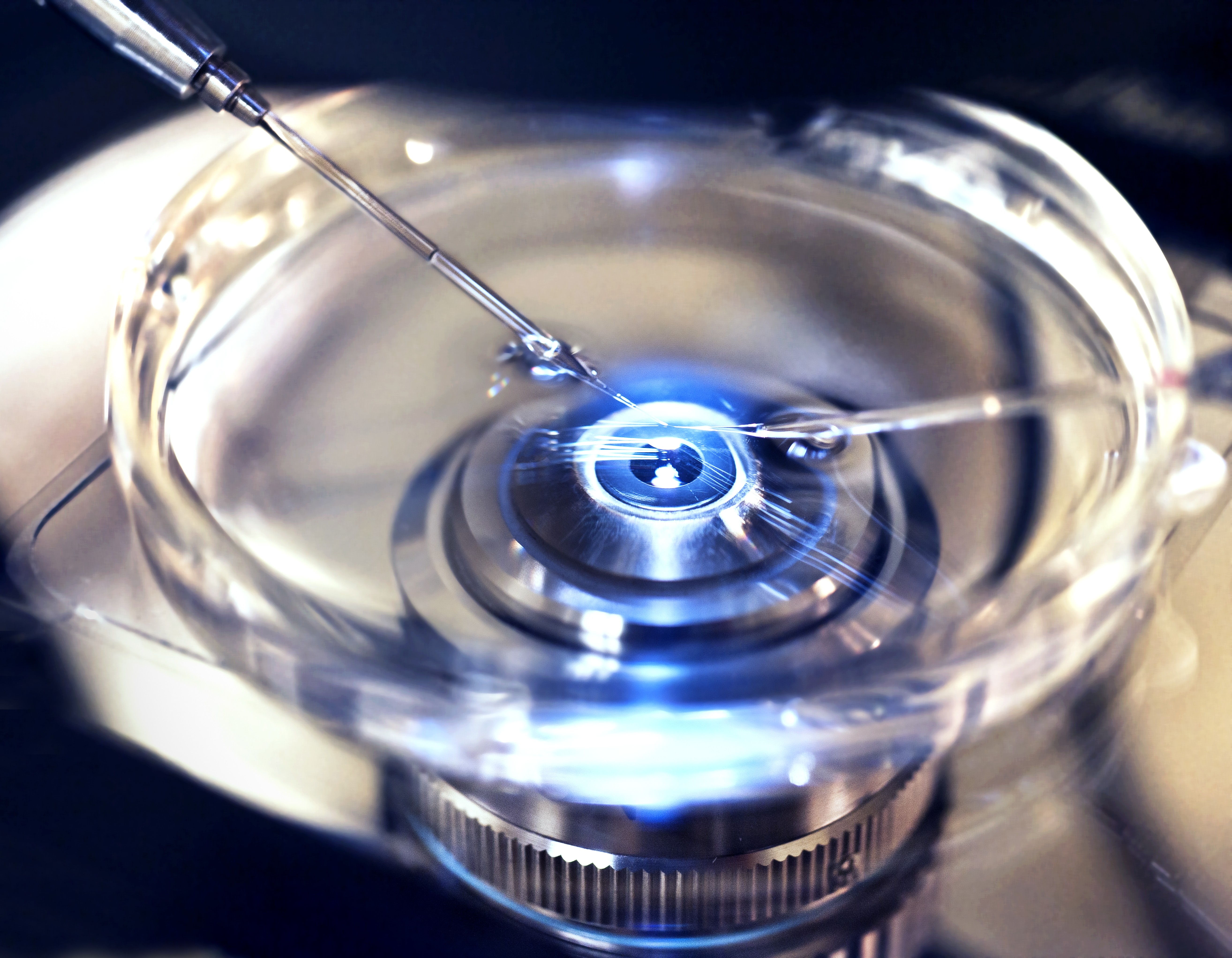Cresce o número de fertilizações in vitro (Foto: Getty Images)