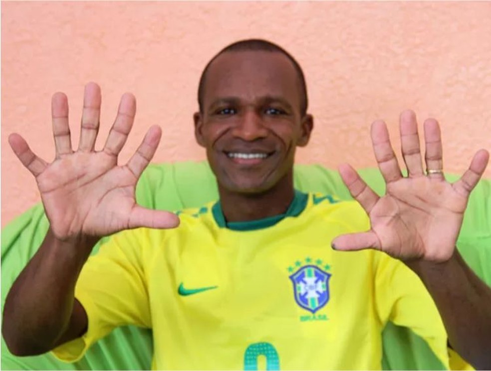 Baiano com seis dedos pretende comemorar hexa da seleção com uma mão só — Foto: Raimundo Mascarenhas/Calila Notícias