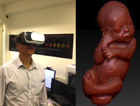 Heron testando a tecnologia da realidade virtual para exploração das imagens intrauterinas (Foto: Arquivo pessoal)
