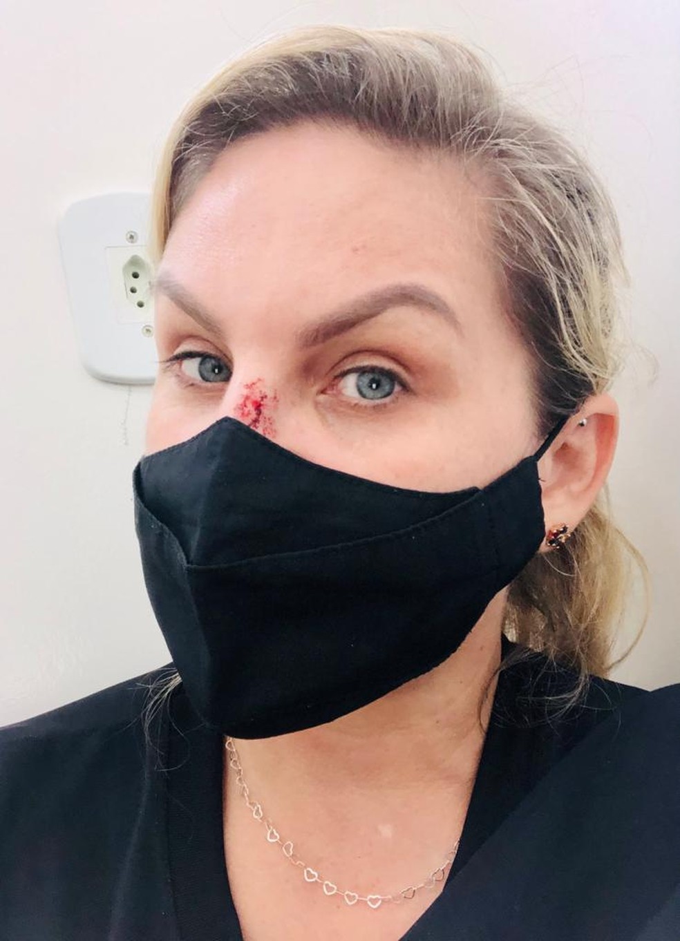 Segundo Marizane Machado, ela realizou exames recentemente para saber se há a necessidade de realizar uma cirurgia no nariz — Foto: Arquivo pessoal/Marizane Machado 