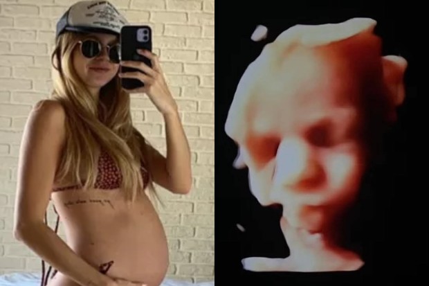 Isabella Scherer mostra ultrassom dos gêmeos (Foto: Instagram)