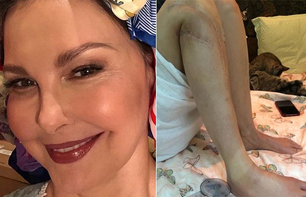 Ashley Judd exibe cicatrizes de acidente (Foto: reprodução/instagram)