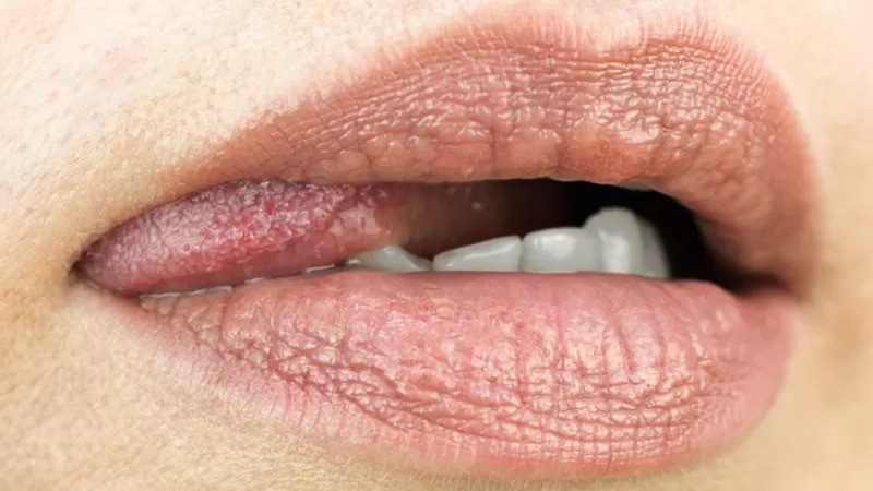 Contato entre a boca e a genital pode favorecer o surgimento de uma ou até várias ISTs (Foto: GETTY IMAGES via BBC)