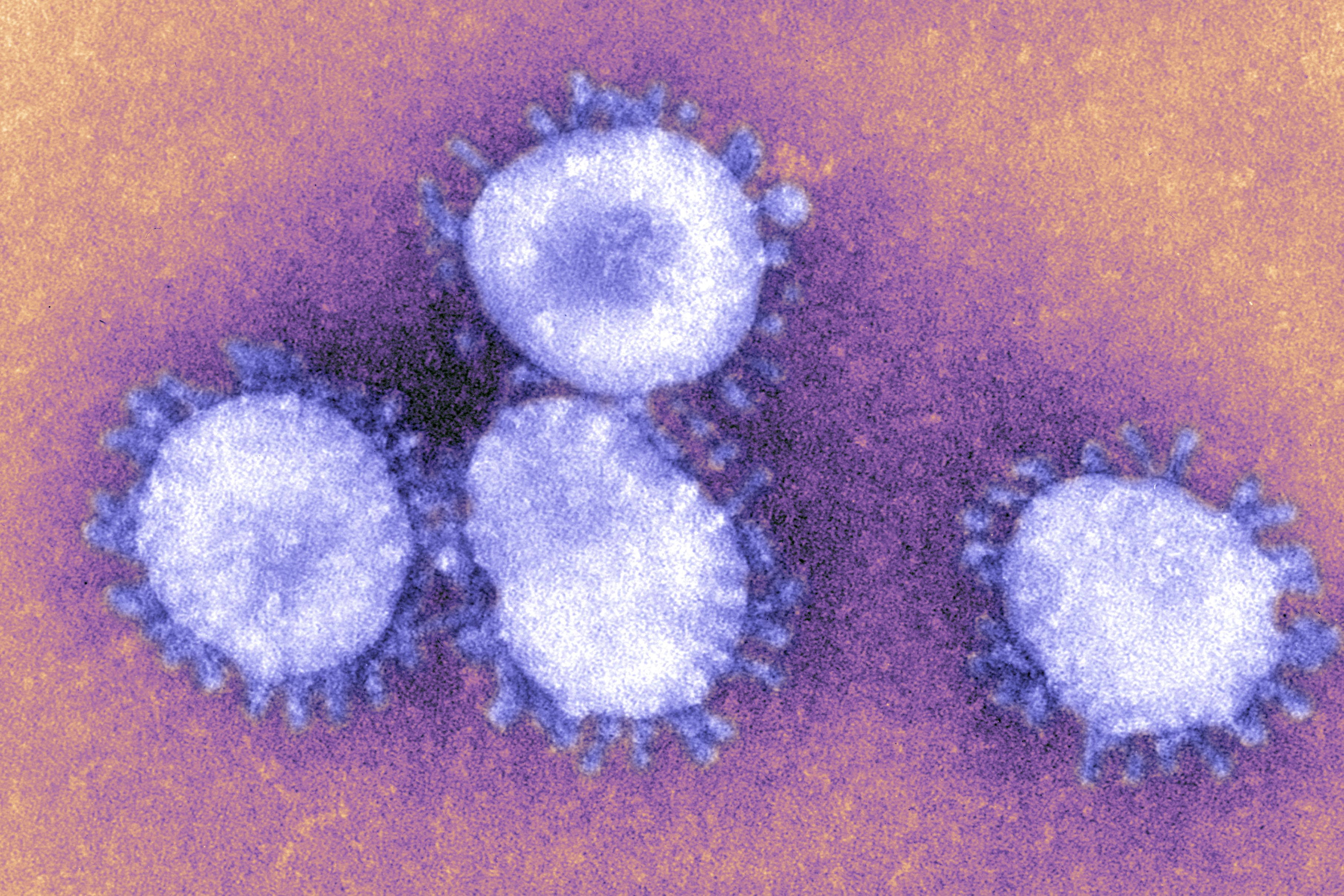 The Coronaviruses Owe Their Name To The The Crown Like Projections, Visible Under Microscope, That Encircle The Capsid. The Coronaviruses Are Responsible For Respiratory Ailments And Gastro Enteritis. The Virus Responsible For Sars Belongs To This Family. (Foto: Universal Images Group via Getty)