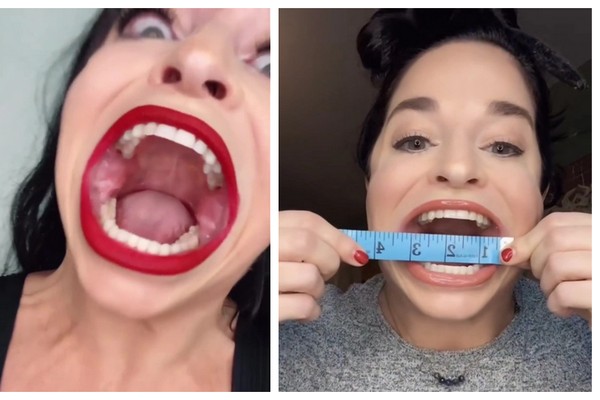 Mulher com &quot;a maior boca do mundo&quot; causa sensação nas redes e ganha mais de  81 mil reais por vídeo postado - Monet | Celebridades