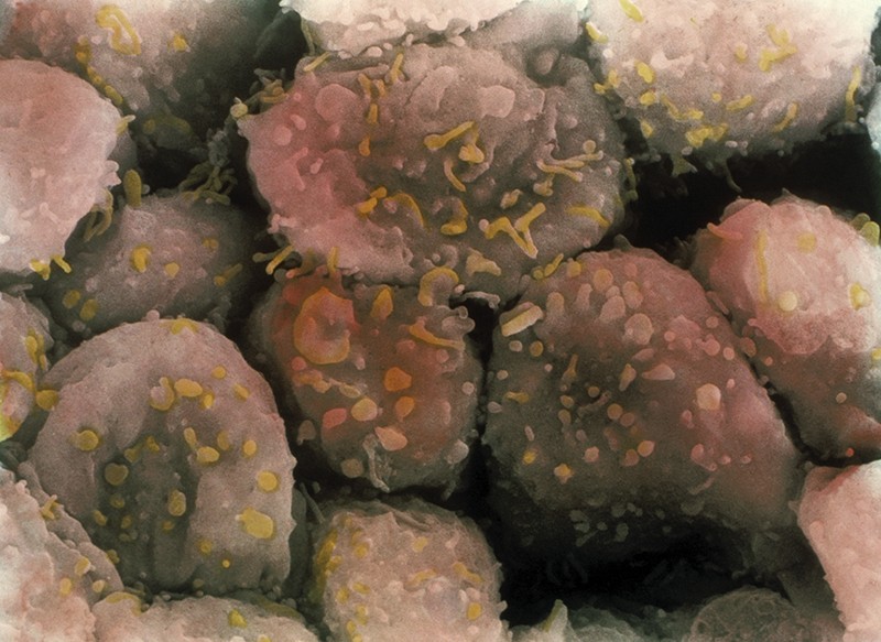 Micrografia eletrônica mostrando as células da superfície de um ovário pós-menopausa (Foto: PM Motta & S. Makabe / Science Photo Library)