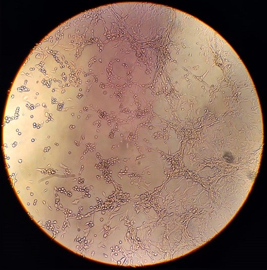 Alteração na célula causada pela infecção do vírus da varíola dos macacos (Foto: Milene Dias Miranda, IOC/Fiocruz)