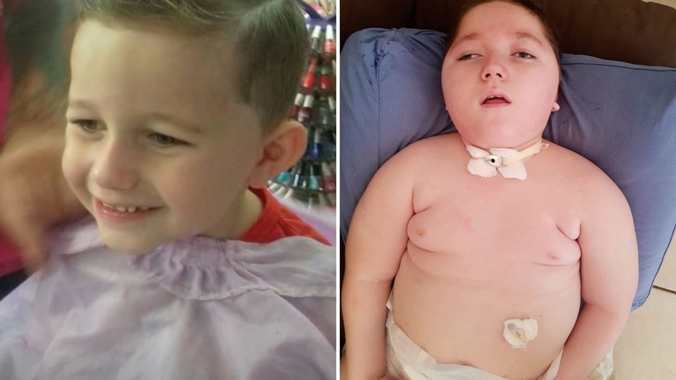 Miguel Samuel Sampaio, de 8 anos, foi diagnosticado com uma doença rara conhecida como Síndrome de FIRES — Foto: Peterson Samuel da Silva/Arquivo pessoal
