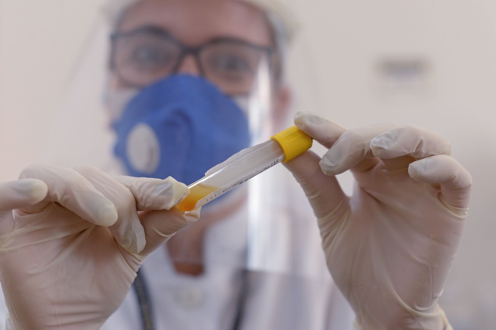 Teste Covid-19 realizado no Laboratório Municipal de Palmas — Foto: Raiza Milhomem/Prefeitura de Palmas/Divulgação