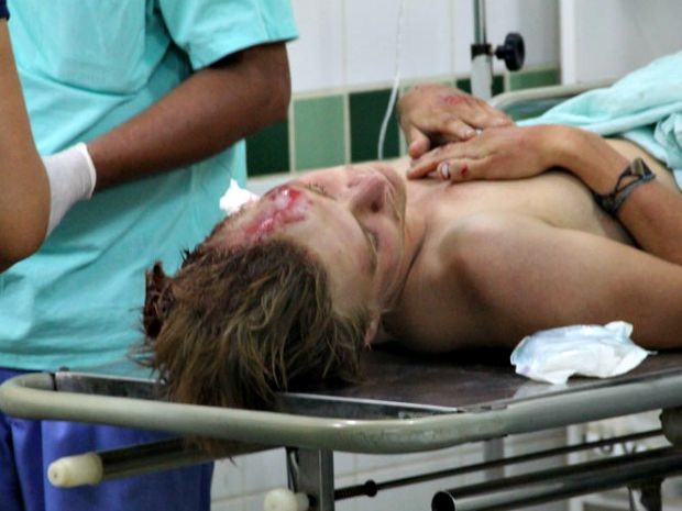 Andreas, de 25 anos, foi encaminhado para o Pronto-Socorro em Rio Branco com traumatismo craniano  (Foto: Alexandre Lima/Arquivo pessoal)