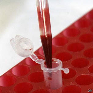 No futuro, exame de sangue poderá prever envelhecimento (Foto: BBC)