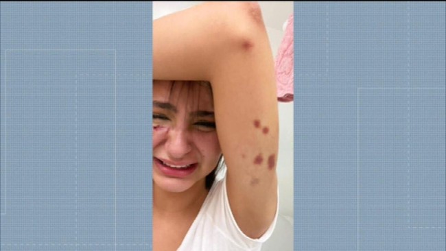 Modelo Anna Figueiredo denuncia em rede social ter sido agredida por ex-namorado em Niterói