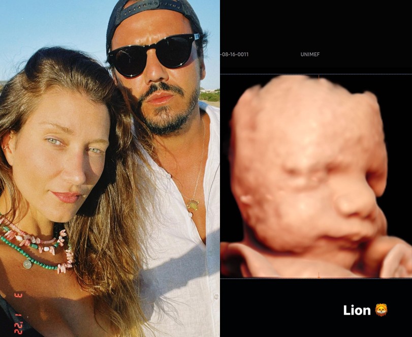 Gabriela Pugliesi mostra ultrassom 3D do primeiro filho com Tulio Dek (Foto: Reprodução/ Instagram)