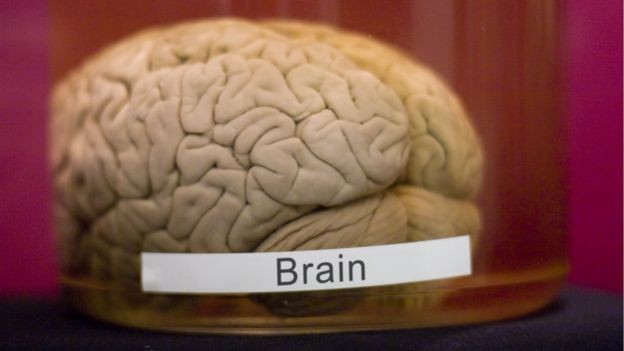 A longo prazo, os cientistas esperam encontrar melhores formas de proteger o cérebro após traumas  (Foto: Getty Images/via BBC News Brasil)