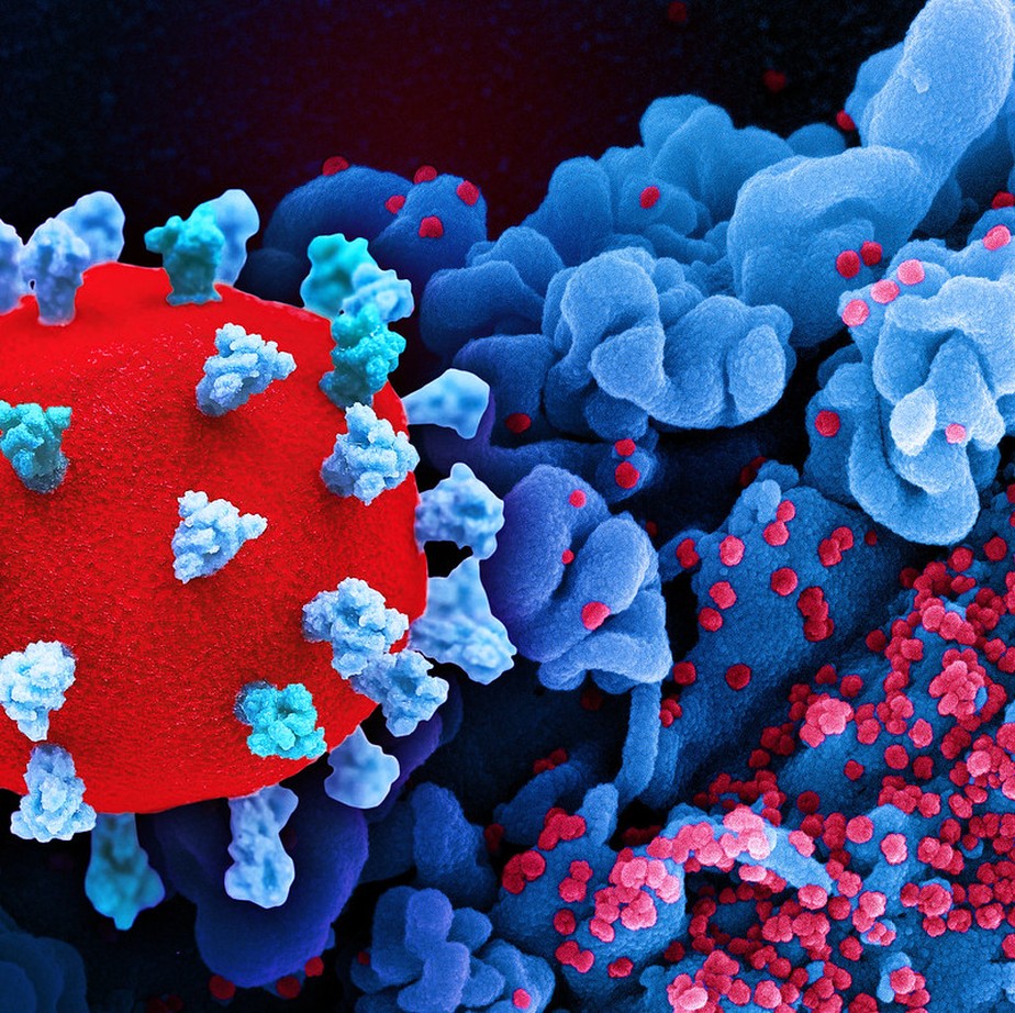 Remédios para HIV e hepatite C não reduzem carga viral da Covid, diz estudo