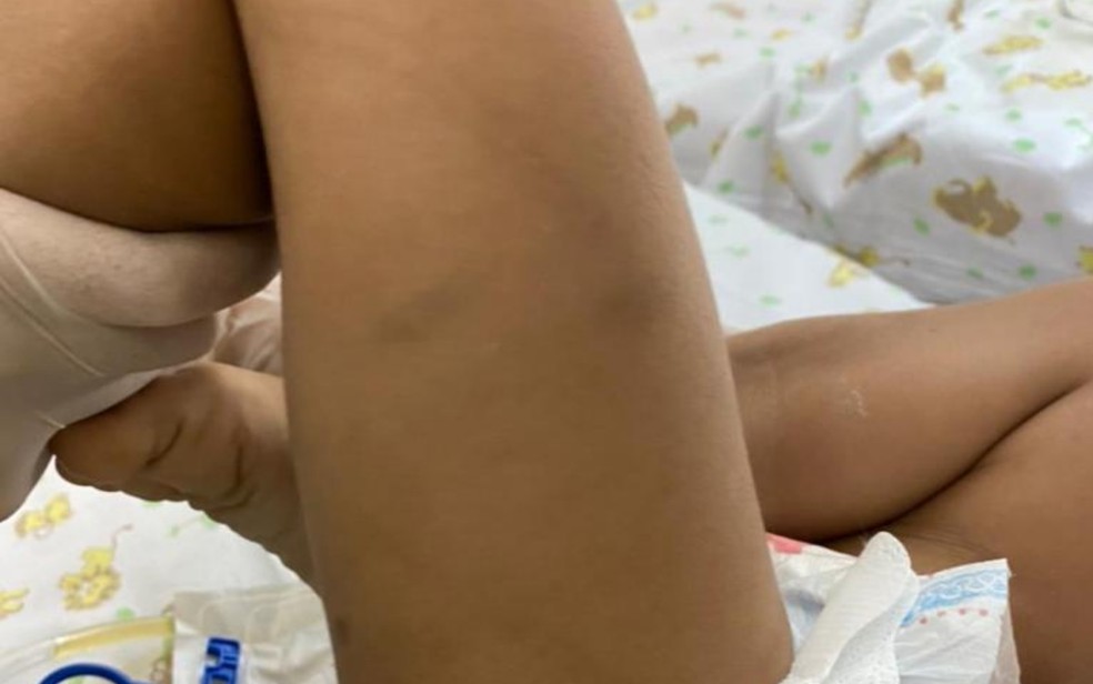 Menina é levada a hospital com lesões no corpo, em Goiânia, Goiás — Foto: Reprodução/TV Anhanguera