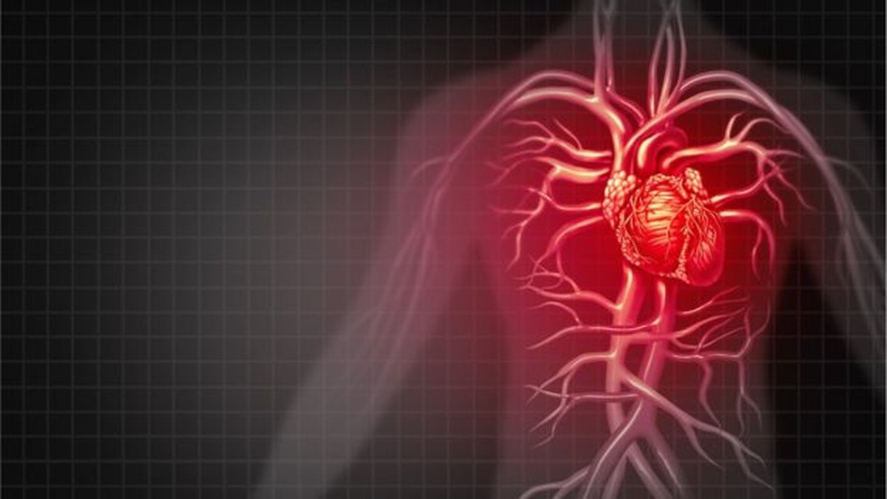 As doenças cardiovasculares são a principal causa das mortes prematuras — Foto: Getty Images