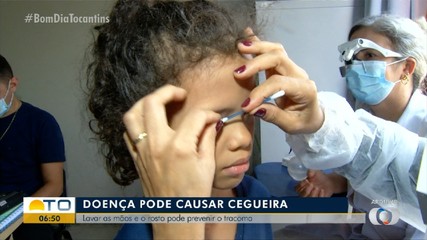 Tracoma: Saiba como proteger seus filhos de doença que pode causar cegueira