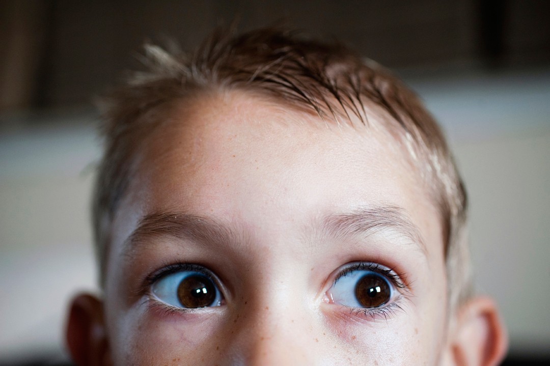 Cuidar dos olhos dos seus filhos vai além de pedir que eles parem de coçá-los - mas começa por aí (Foto: Getty Images)