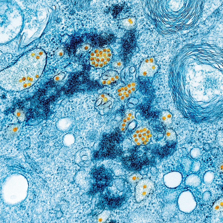 Vírus da febre amarela em cultura de células de laboratório