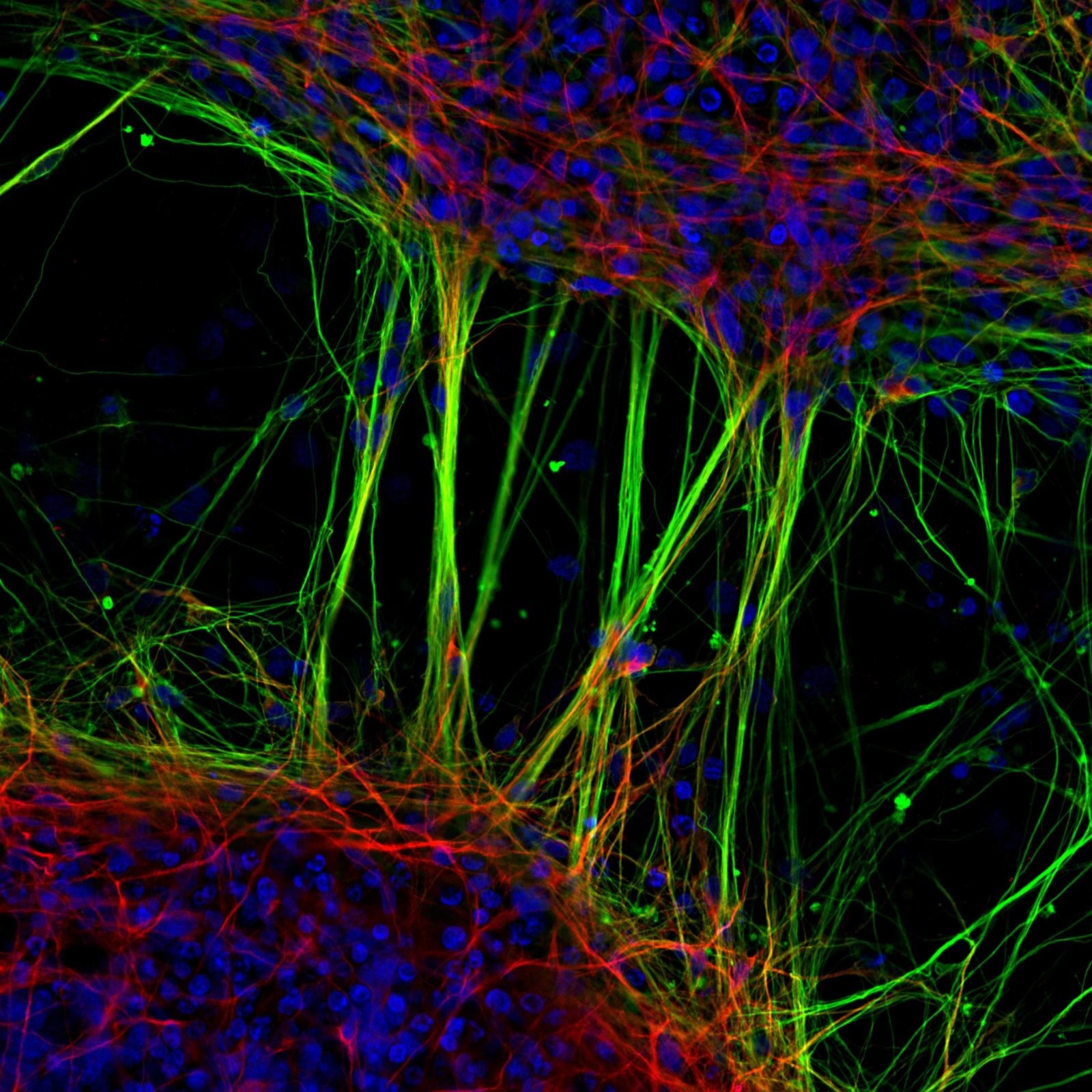 Neurônios humanos derivados de células- tronco neurais (Foto: Reprodução/ Jianqun Gao e Glenda Halliday)
