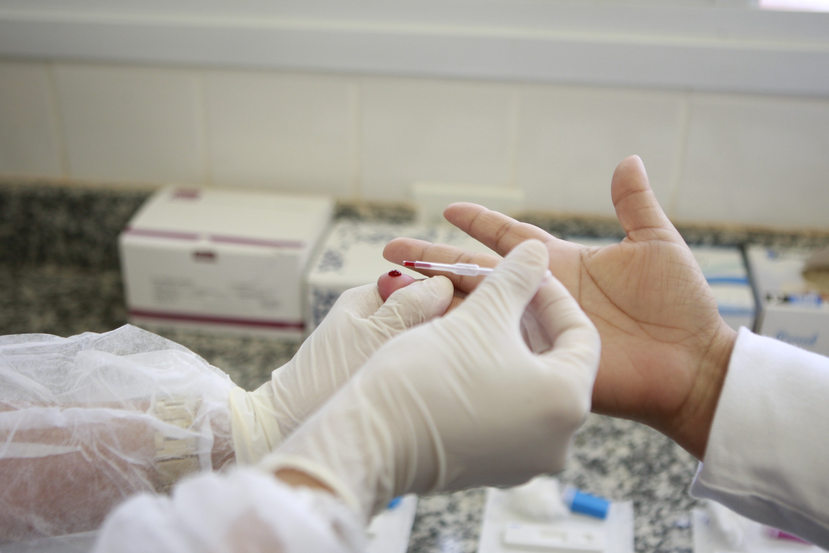 Aids: Uberlândia registra maior número de diagnósticos da doença em cinco anos