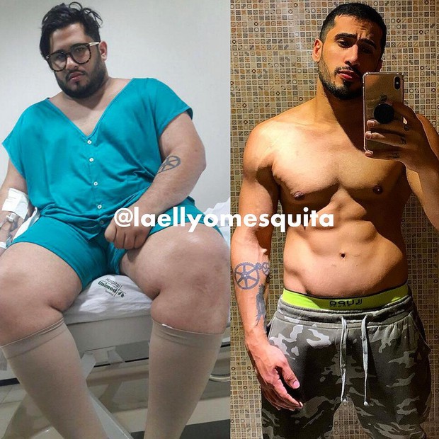 Laéllyo Mesquita️️️️️ antes e depois de perder 70 kg (Foto: Arquivo pessoal)