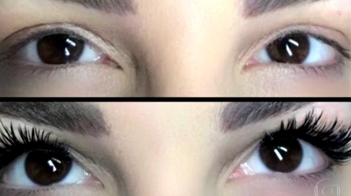 Alongamento De Cilios Pode Causar Queimaduras Durante Ressonancia Magnetica Entenda Viva Voce G1