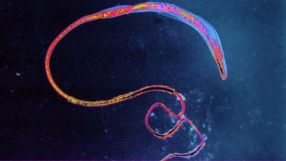 Uma parte importante do plano de conservação de parasitas é catalogá-los e entender quais estão em maior risco — Foto: Getty Images via BBC