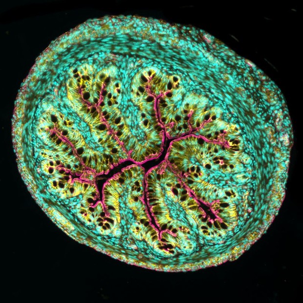 Esta curiosa estrutura oval verde e rosa é, na verdade, o corte transversal do intestino de um camundongo — de autoria de Amy Engevik, da Universidade Médica da Carolina do Sul, nos EUA (Foto: AMY ENGEVIK via BBC)