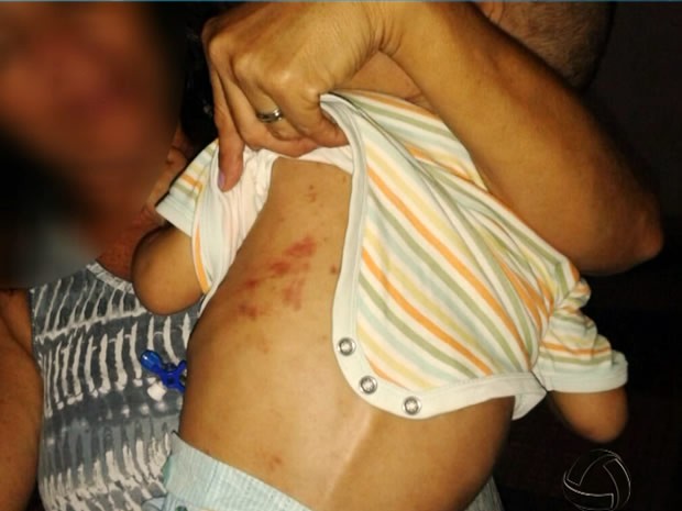 Criança deficiente teria sido vítima de maus-tratos em Mato Grosso. (Foto: Reprodução/TVCA)