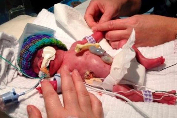 Bella Torkington foi atendida por paramédicos após parto prematuro no banheiro de casa (Foto: Reprodução)