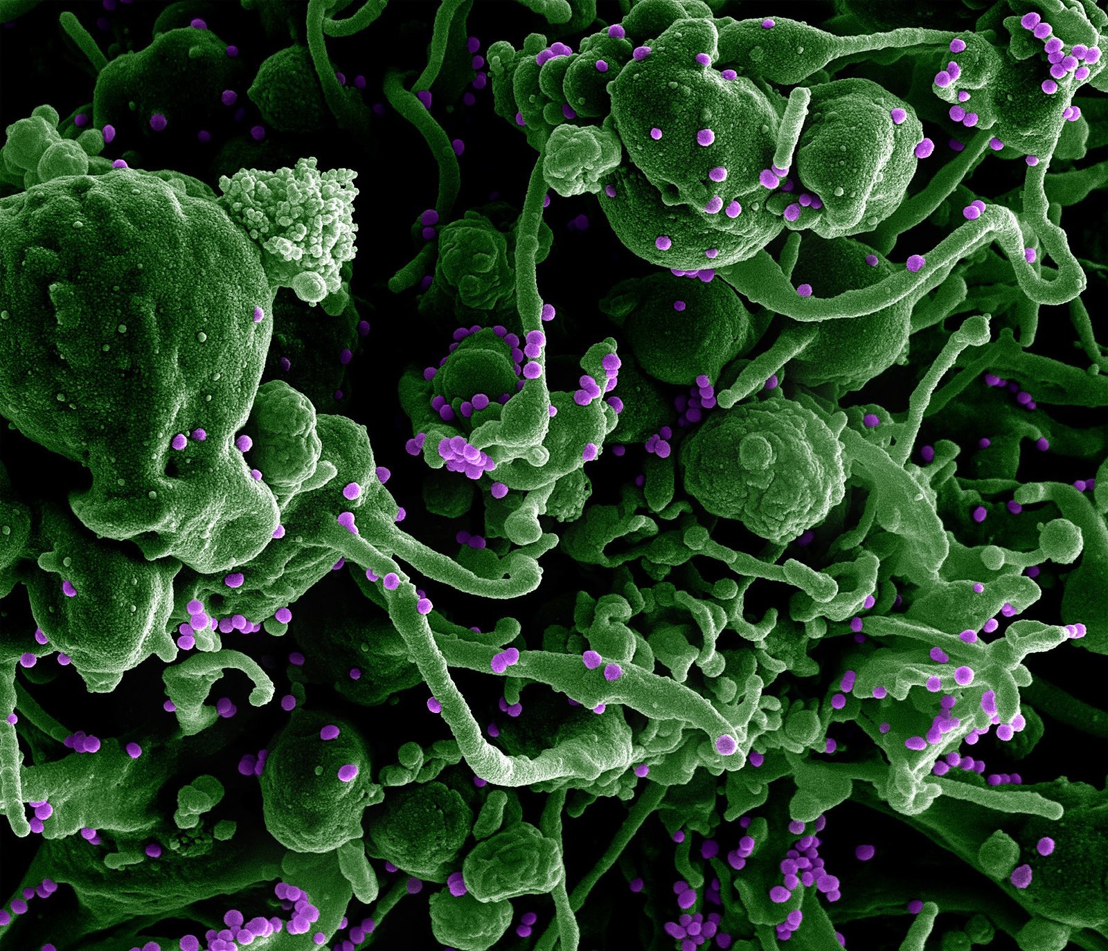 Micrografia eletrônica de varredura do vírus Lassa brotando de uma célula (Foto: NIAID)