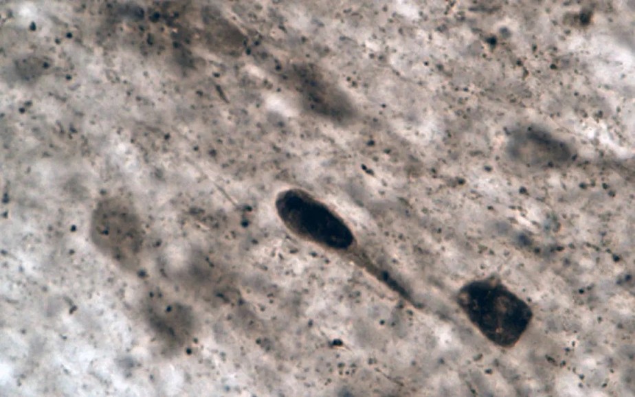 Certas cepas da bactéria Desulfovibrio podem ser a causa de Parkinson