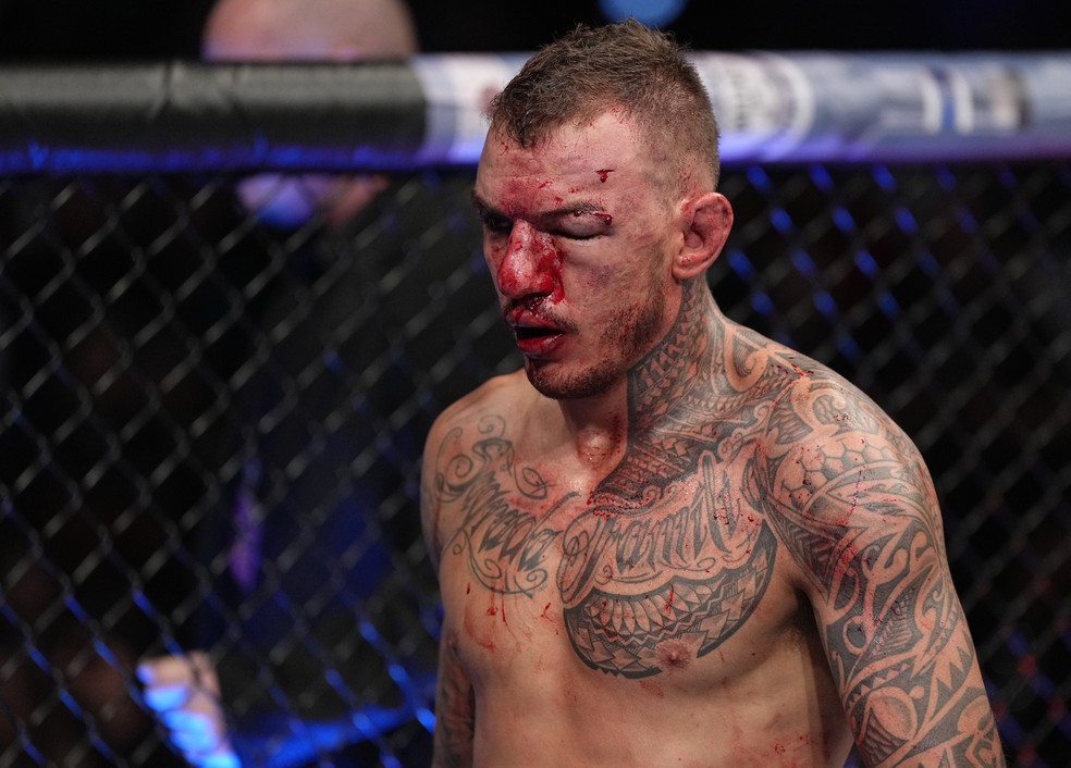 Renato Moicano foi levado para o hospital logo aps a luta contra Rafael dos Anjos no UFC 272  Foto: Getty Images