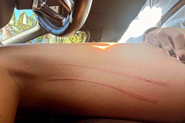 A modelo Camila Morrone mostrou os arranhões na perna feitos pelo cãozinho Jack (Foto: Instagram)