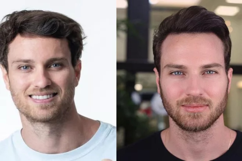 Antes e depois de Lucas Bissoli  — Foto: Reprodução