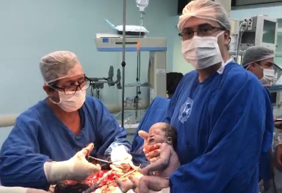 Médico de Rio Preto faz parto de gêmeos e um dos bebês tem nascimento empelicado — Foto: Luiz Fernando Gonçalves Borges/Arquivo Pessoal