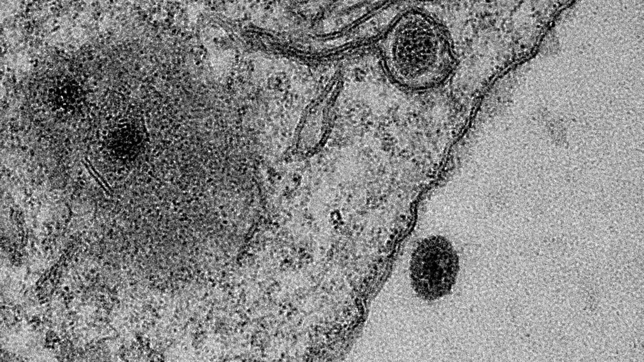Vírus completamente novo é descoberto no Lago da Pampulha, em Minas Gerais. Yaravirus (mais escuro) infecta uma amoeba (Foto: Universidade Federal de Minas Gerais/bioRxiv)
