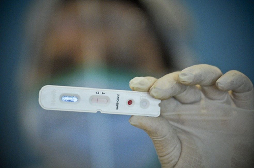 Testagem rápida de coronavírus no DF  — Foto: Breno Esaki/Agência Saúde