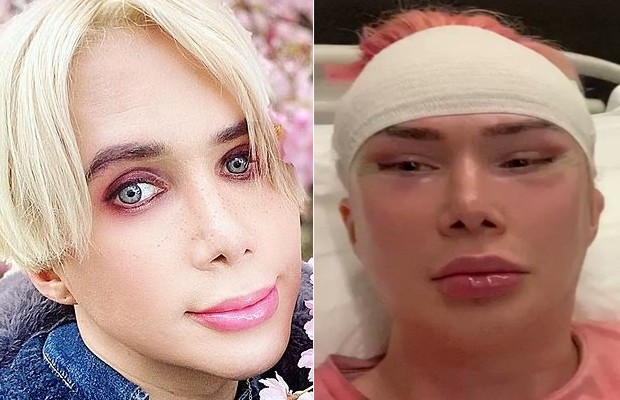 O influenciador britânico passa por cirurgia para se parecer com estrela do K- pop (Foto: Reprodução/Instagram/Twitter)