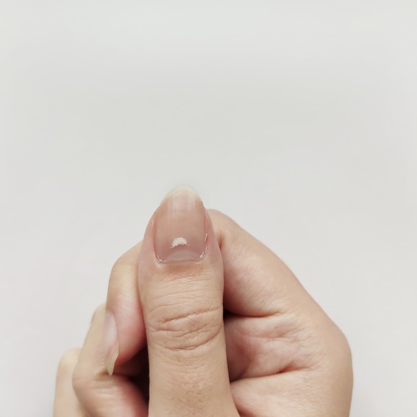 Ondulações e 'estrias' de unhas: saiba como tratar  (Foto: Getty Images)