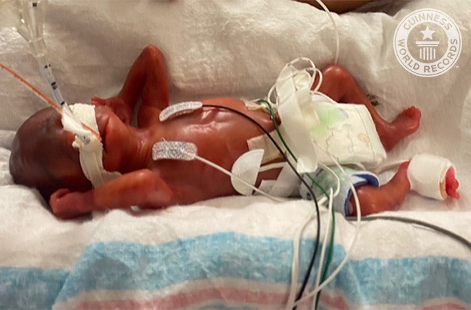 Curtis Zy-Keith Means nasceu prematuro com apenas 21 semanas de idade (Foto: World Guinness Records )