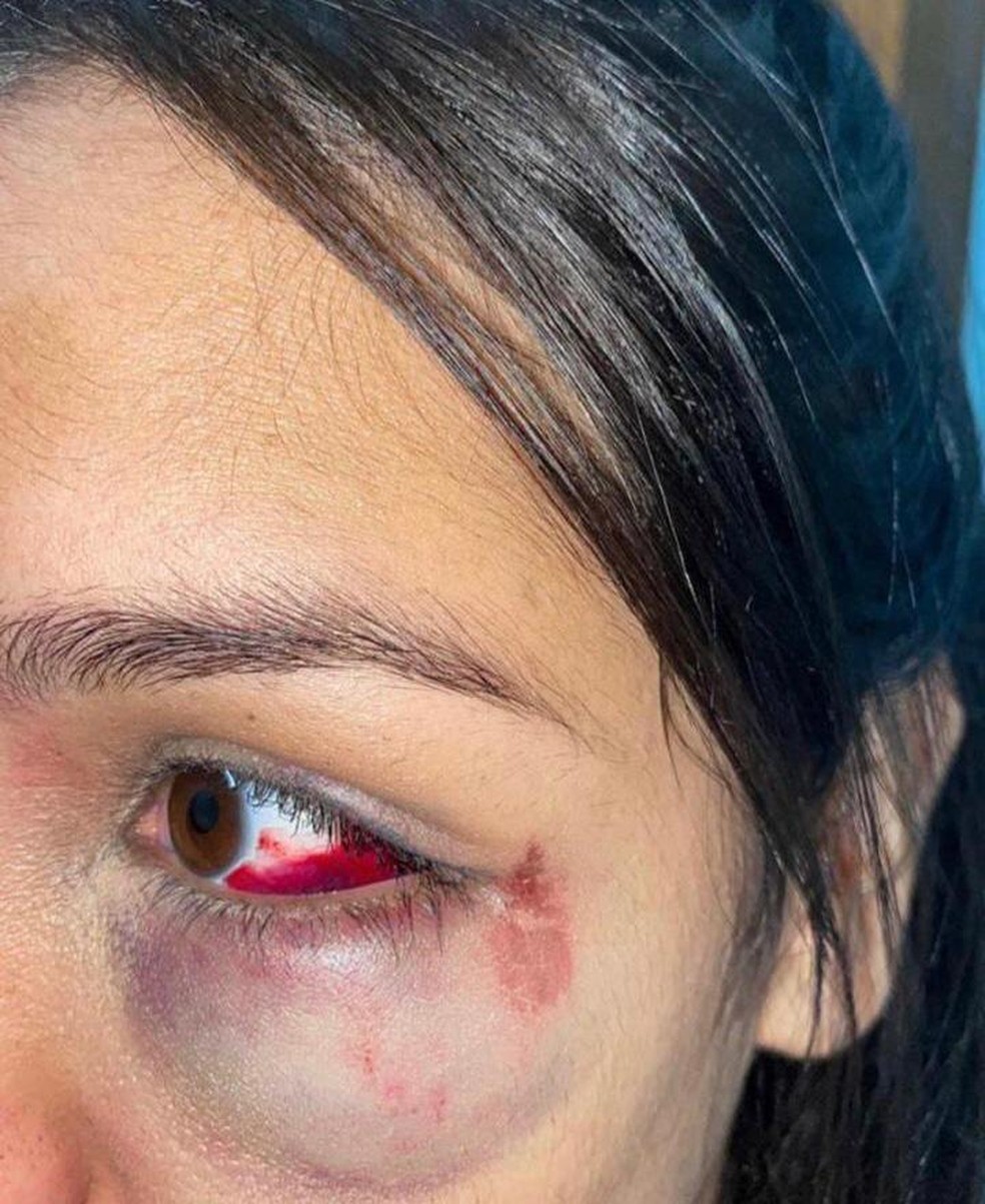 Jovem de 19 anos denuncia agressão feita por PM em evento no extremo sul da Bahia — Foto: Arquivo Pessoal